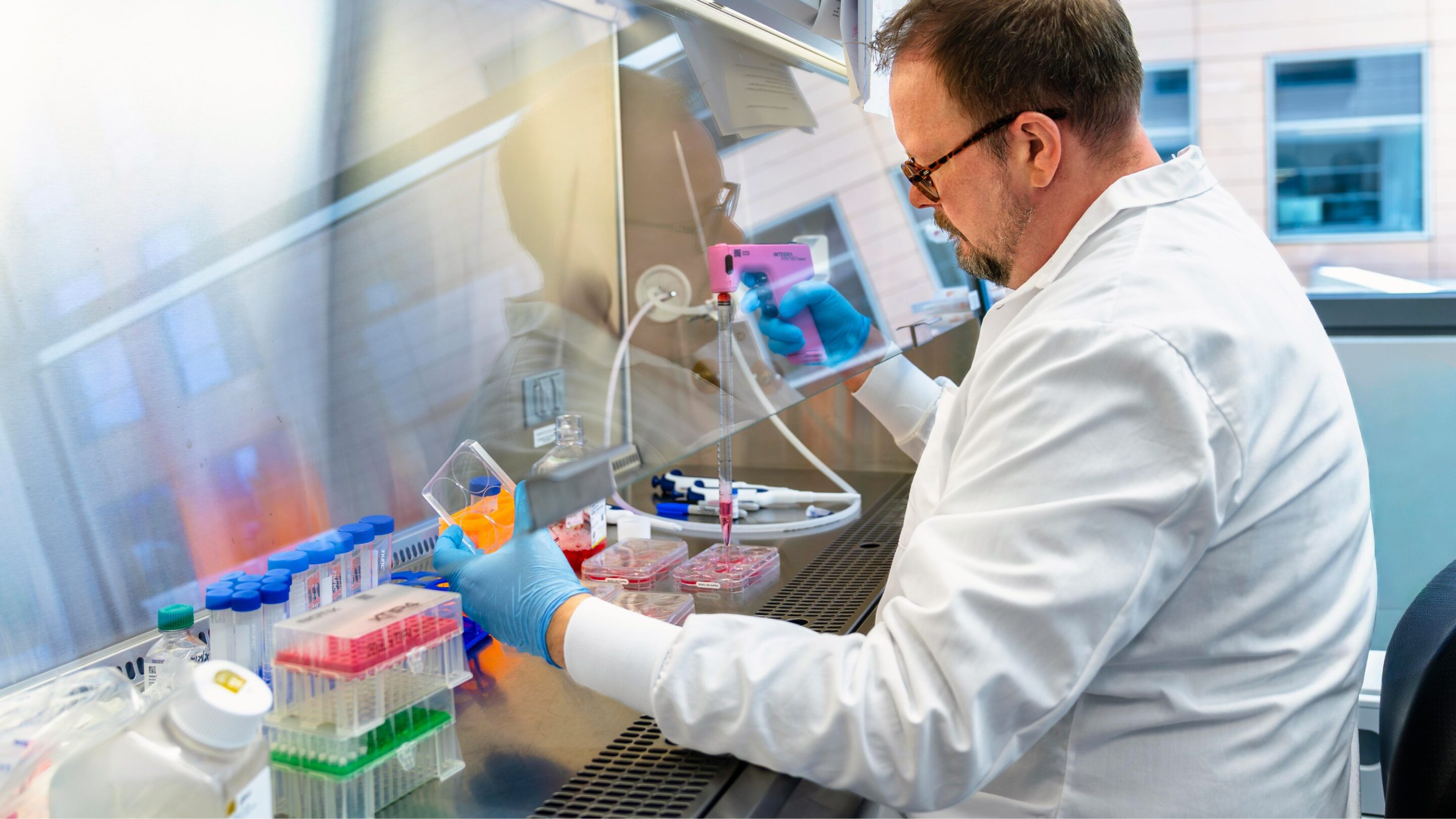 Image Genetic Dilated Cardiomyopathy
